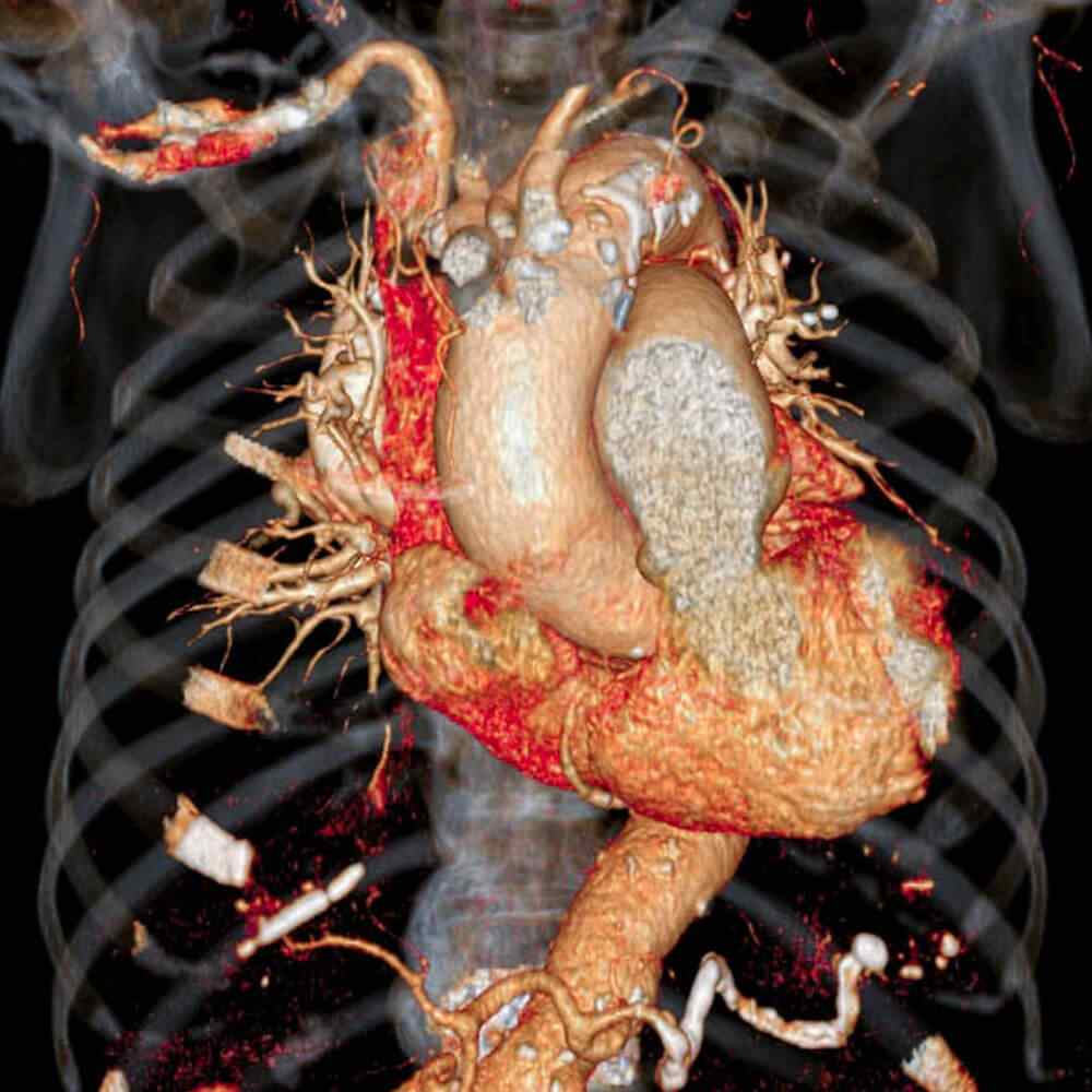 inner_image_03 https://gokcek.pansocial.me/wp-content/uploads/2021/08/inner_image_03.jpg